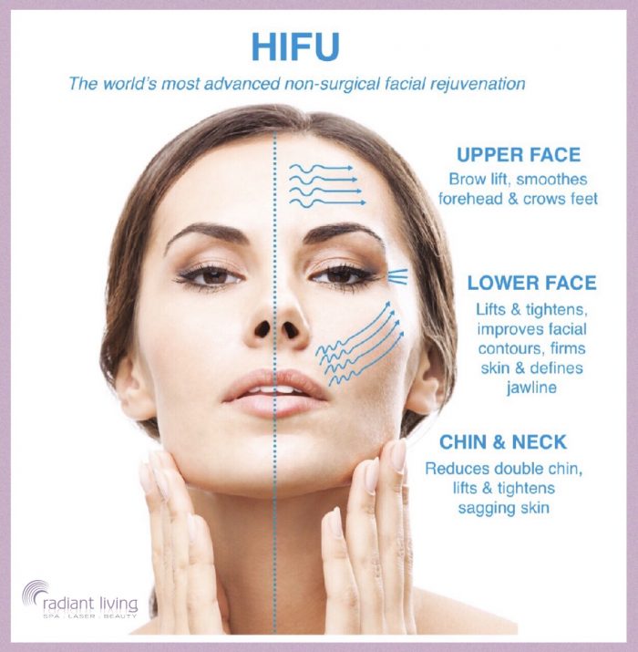 HIFU Face Lift