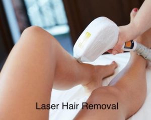 IPL or Laser Hair Removal