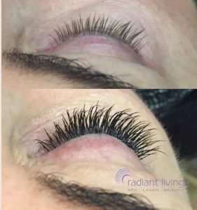 Before and After Classic Lashes