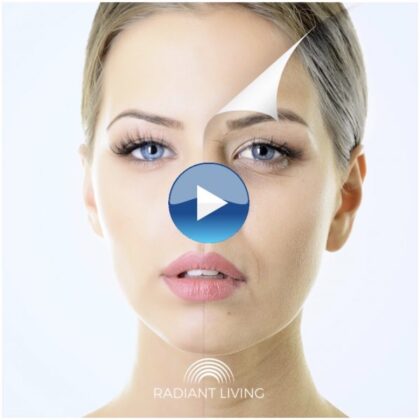 VIDEO: What is a skin peel treatment? Watch a peel here!