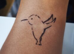 How much does Laser tattoo removal cost?