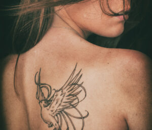 tattoo removal