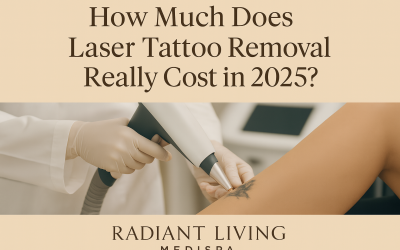 How Much Does Laser Tattoo Removal Really Cost in 2025