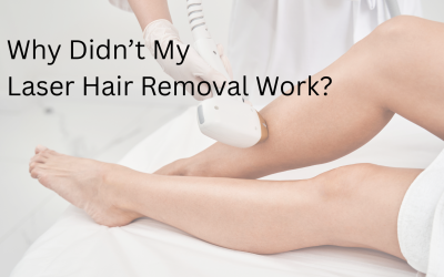 Why Didn’t My Laser Hair Removal Work?