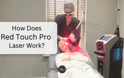 How Does Red Touch Pro Laser Actually Work?