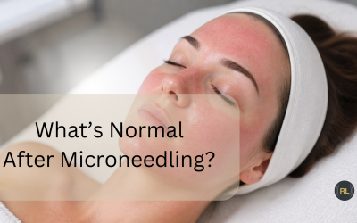 Microneedling Side Effects: What’s Normal – and Are There Gentler Alternatives?