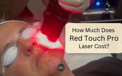 How Much Does Red Touch Pro Laser Cost in the UK